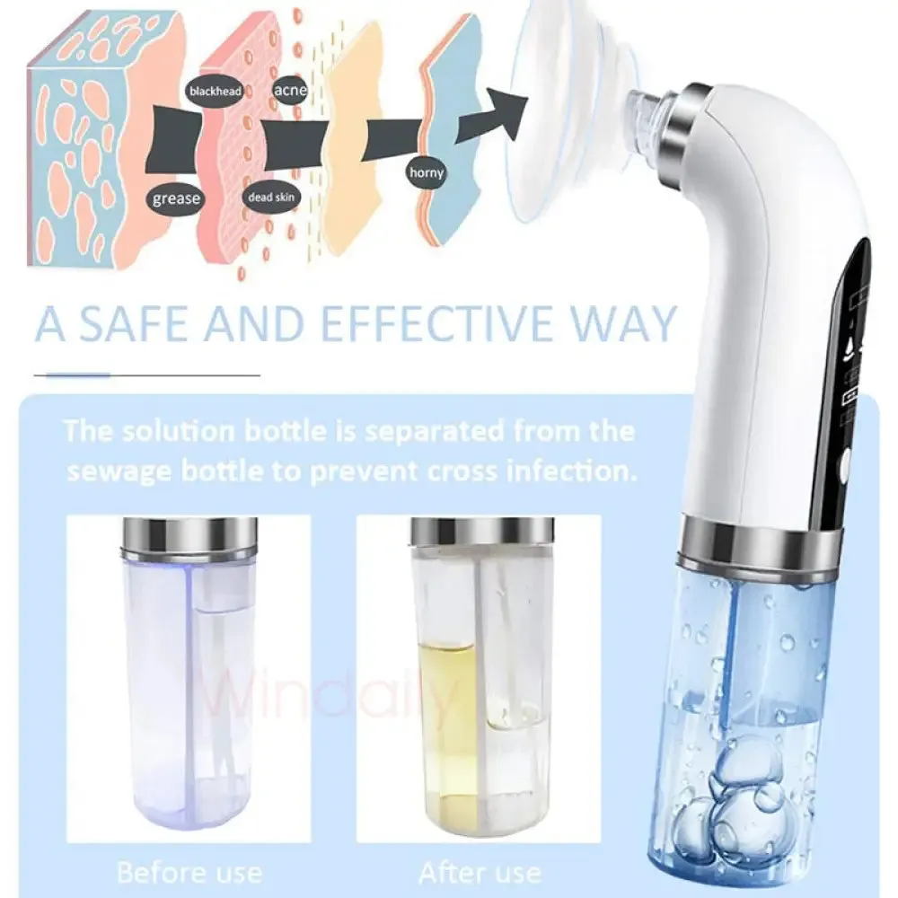 Electric Usb Rechargeable Micro Small Bubble Blackhead Remover Vacuum Cleasing Machine