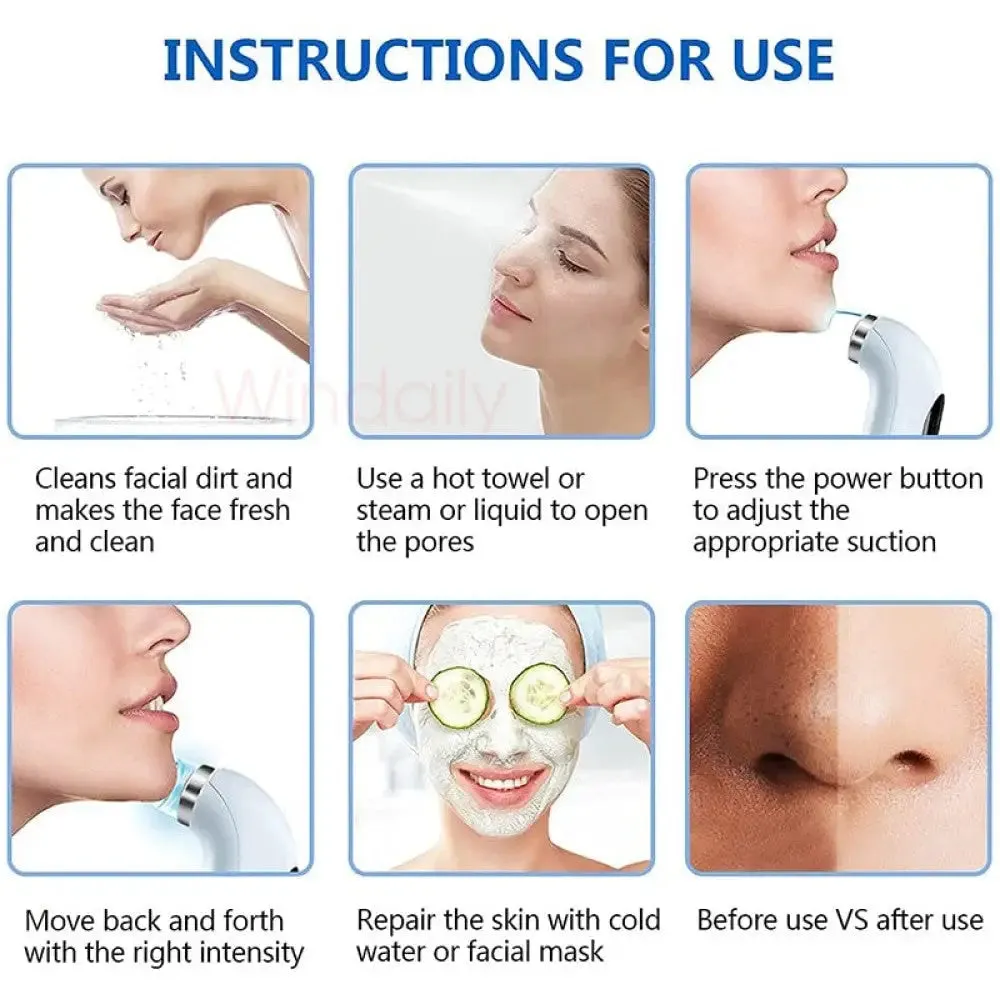 Electric Usb Rechargeable Micro Small Bubble Blackhead Remover Vacuum Cleasing Machine